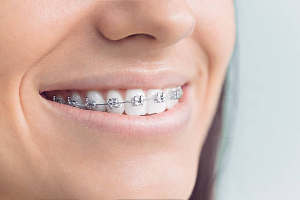 Full Mouth Reconstruction in Blue Mound, IL